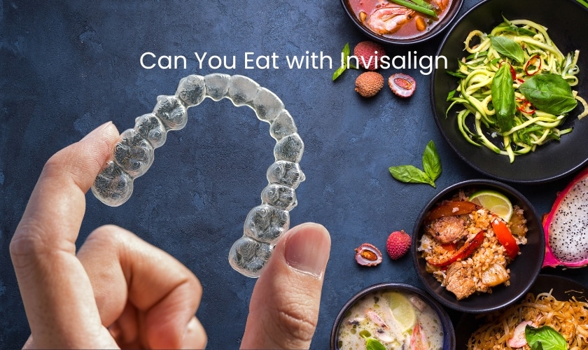 Can You Eat with Invisalign - FLOSS Dental Sugar Land