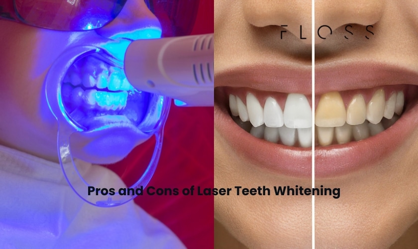 Pros and Cons of Laser Teeth Whitening